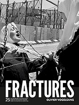 Fractures
